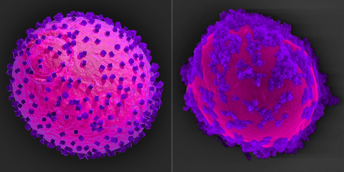 The researcher’s model of a yeast cell (magenta) with semiconductor nanoparticles (purple) attached to its surface (left) corresponds with their SEM analysis of the completed biohybrid system (right).
