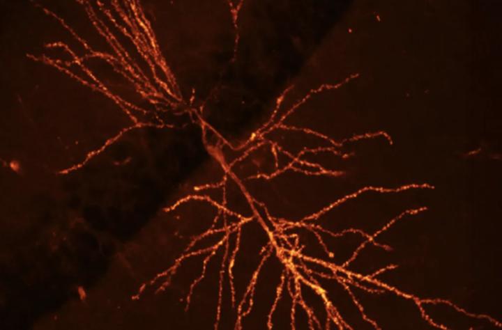 A combination of fluorescent labeling and cutting-edge microscopy allowed the researchers to illuminate synaptic behavior at unprecedented resolution.  Credit: Pojeong Park