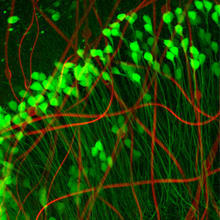 Neuron-like electronics